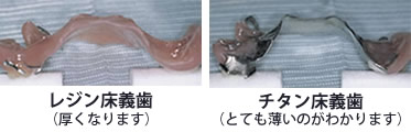 レジン床義歯