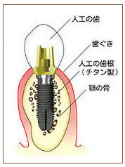 ロゴを挿入